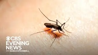 More locally-acquired malaria cases reported in U.S.