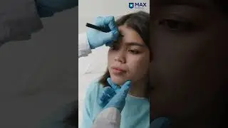 Maxillofacial Surgery: Comprehensive Care for Facial and Jaw Issues