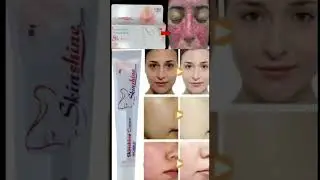Skin Shine Cream ! #haircare #skinbeautytips #skincareproduct #beauty #ytshorts #skincareroutine