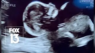 Despite lethal diagnoses, Florida abortion law blocks families from termination