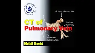 MedImag: CT of Pulmonary Vein with ECG Gating, SOMATOM&reg; Definition Flash, Dual Source, 256 Slice