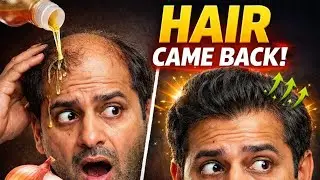 Extreme hair growth formula. Fermented onion juice remedy science explained