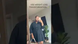 VSG WEIGHT LOSS BEFORE AND AFTER #VSG #WEIGHTLOSS