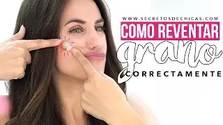 Cómo reventar un grano correctamente sin dejar cicatriz | Trucos de belleza