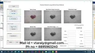 Disease Detection using Artificial Neural Network (MatLab)