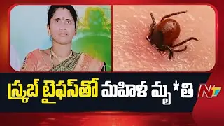 Woman D*ies Of Scrub Typhus In Vizianagaram District | NTV Telugu