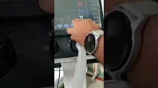 SV300 ventilator mindray describe