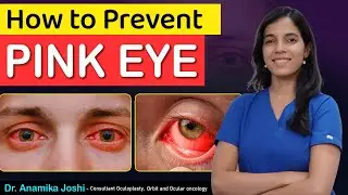 How to prevent pink eye | How to prevent conjunctivitis eye | Dr Anamika Joshi