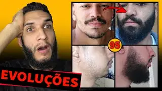 EVOLUÇÃO DOS INSCRITOS / MINOXIDIL #95 🔥