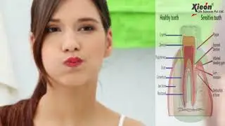 Dental Range by Xieon Life Sciences Pvt  Ltd