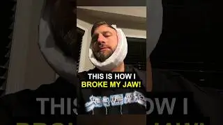 The Painful Truth About My Broken Jaw Story