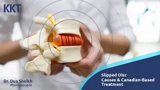 Disc Herniation Treatment - Non-Surgical #kkt #slippeddisc #painrelief #health #discherniation #care