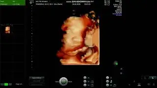 GỬI MẸ NGUYỄN THỊ KHANH VIDEO B&Eacute; 30 TUẦN 05 NG&Agrave;Y