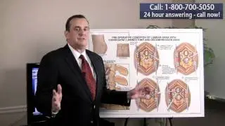 Atlanta Injury Attorney Greg Stokes Discusses - What is a Pre-existing Condition?