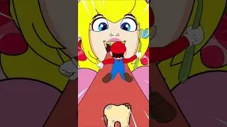 Obstacle Challenge &ndash; Clean Princess Peach&rsquo;s Teeth