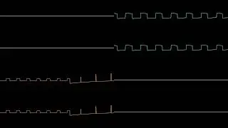 Experiments: Atari Lynx Samples
