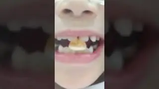 jolly gummies orange