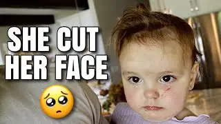 ONE-YEAR-OLD INJURES & CUTS FACE WHILE PLAYING WITH SIBLINGS IN SPRINKLERS