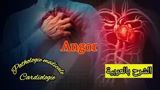 Angine de poitrine ou Angor || Cardiologie | Pathologie médicale