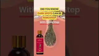Roopayur Skin Healing Gel #skincare