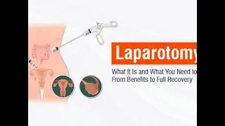 Exploratory Laparotomy; surgical procedure where abdomen is opened to diagnose or treat