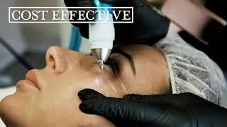Fibroblast Plasma Blaze Needling Training - Beverly Hills CA