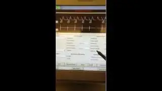 Shutting off Pacemaker