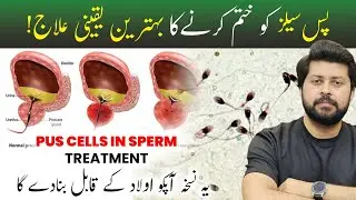 Pus Cells ka ilaj in Urdu Hindi | Pus Cells in Sperm Treatment in Urdu Hindi | Herbalist Ahmad Raza