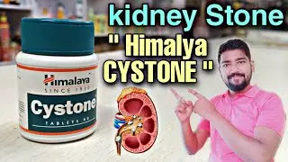 Cystone Tablet Uses in Hindi | पथरी की सबसे लाभकारी दवा | Best Ayurvedic Medicine for Kidney Stones