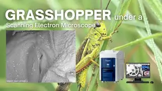 Grasshopper under the Microscope (SEM) | Uncut