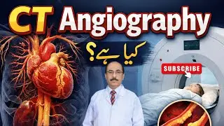 CT Angiography Kia Hai? Complete Guide by Dr Waqar