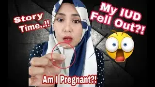 MY IUD EXPERIENCE - [MY IUD FELL OUT AND Am I PREGNANT???]