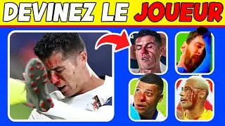 Qui s'est BLESS&Eacute;...?🤕 Cartons Rouges, Blessures, Pires Moments des Footballeurs ⚽ Mbappe, Ronaldo
