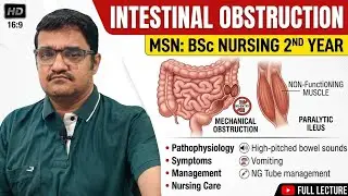 Intestinal Obstruction Explained | Digestive disorders | MSN Nursing Lecture | BSc Nursing 2nd Year