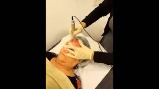 The Skin Practice - Micro Needling