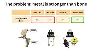 🦴⚙️ IGNITE Project | (Natural Materials & Biomaterials) Module 2 &ndash; Stress Shielding in Biomaterials