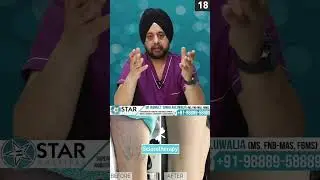 What are Spider Veins? Spider Veins - Causes, Symptoms, Excercise & Treatment at Home
