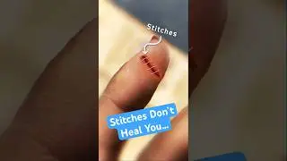 Stitches Don't Heal You...