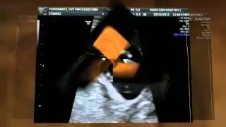 Hyemin's First Prenatal Ultrasound