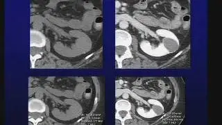 BODY IMAGING BOOT CAMP: preview clip 2-Israel