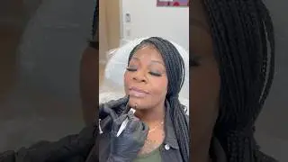 Chin and DAO muscle botox#botox #filler #botoxfiller #skintreatment