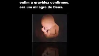 Hist&oacute;ria do Arthur JLREIS