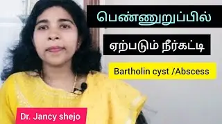 Bartholin cyst /Abscess in tamil #causes #cure # vaginal infection # dr. Jancy shejo