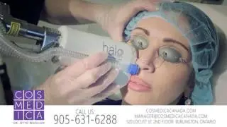 Laser Skin Resurfacing With the Halo&trade; Hybrid Fractional Laser