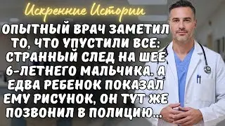 ВРАЧ заметил то, что упустили все: странный след на шее 6-летнего мальчика. А едва ребенок ПОКАЗАЛ