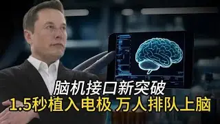 腦機介面新突破！1.5秒植入電極，萬人排隊體驗？
