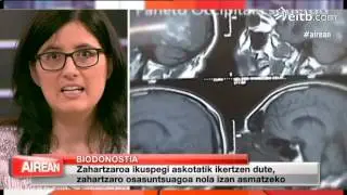 Zahartzaro osasuntsuago baten bila Biodonostia institutuan