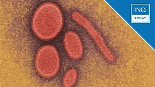 DOH: Nipah virus &lsquo;rare,&rsquo; not in PH since 2014 | INQToday