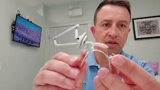 Addition of denture teeth, cast clasps to a partial after extractions.