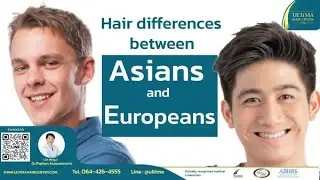 Asian vs. Caucasian Hair:The Differences | Dr. Ming, ABHRS Doctor | Hair Transplant Bangkok Thailand